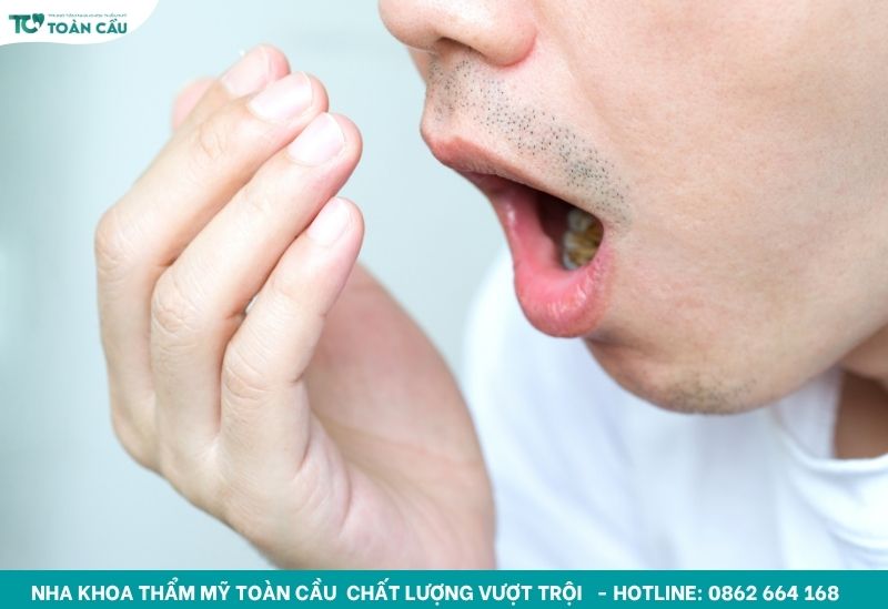 Giải đáp sau khi cấy implant có bị hôi miệng không 4 Bệnh lý sẵn có khiến hôi miệng sau cấy Implant
