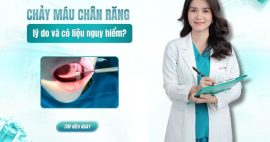 Tại sao lại chảy máu chân răng? Kéo dài có nguy hiểm không?
