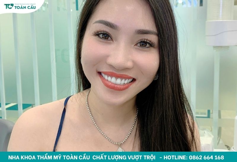 Dán sứ bao nhiêu tiền? Chi phí cho một nụ cười hoàn hảo 5 Khách hàng làm răng sứ tại Toàn Cầu