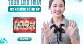 đeo thun liên hàm để làm gì