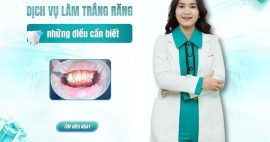 dịch vụ làm trắng răng