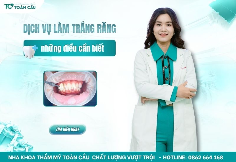 dịch vụ làm trắng răng