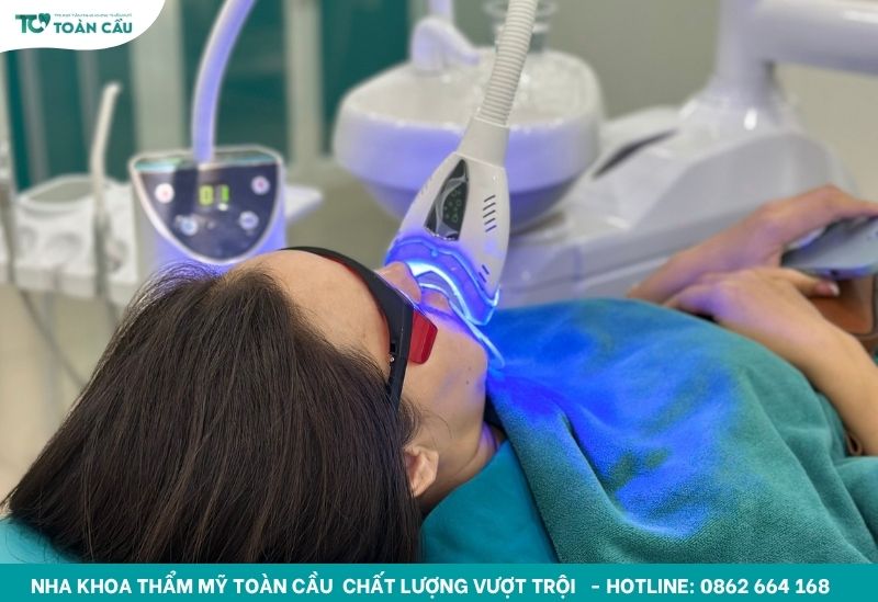 Phương pháp tẩy trắng răng bằng Laser
