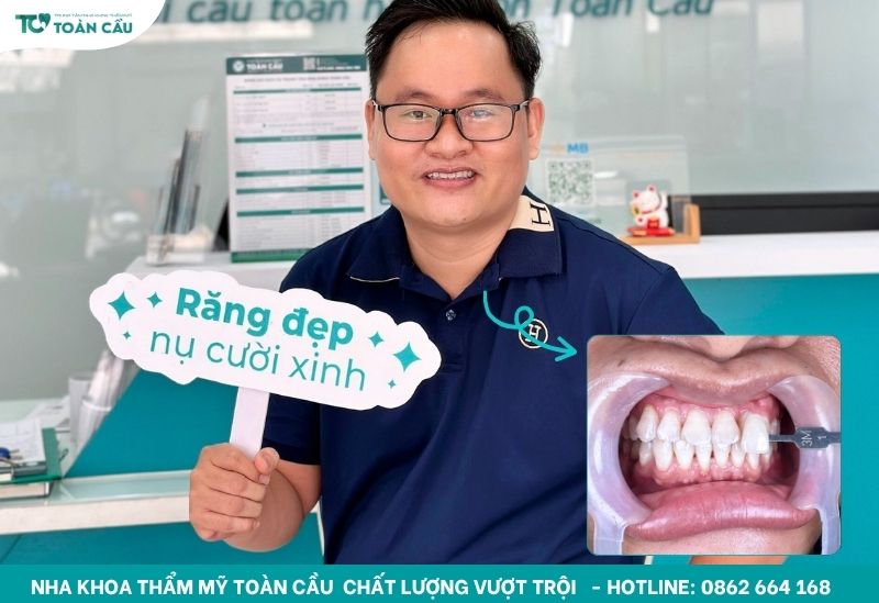 Khách hàng tẩy trắng răng