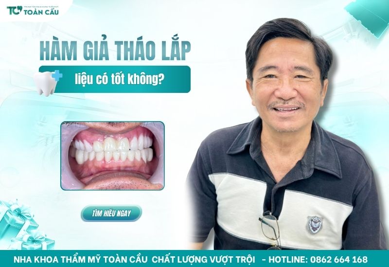 Hàm răng giả tháo lắp cho người già có thật sự tốt không?
