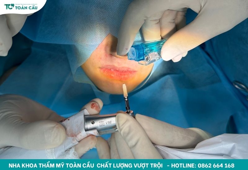 Tuyệt đối không chạm, xoay hay tự tháo healing implant