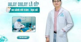 Inlay Onlay là gì? Khác gì so với trám và bọc răng sứ?