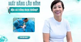 Mất răng lâu năm có trồng được không và chi phí bao nhiêu?
