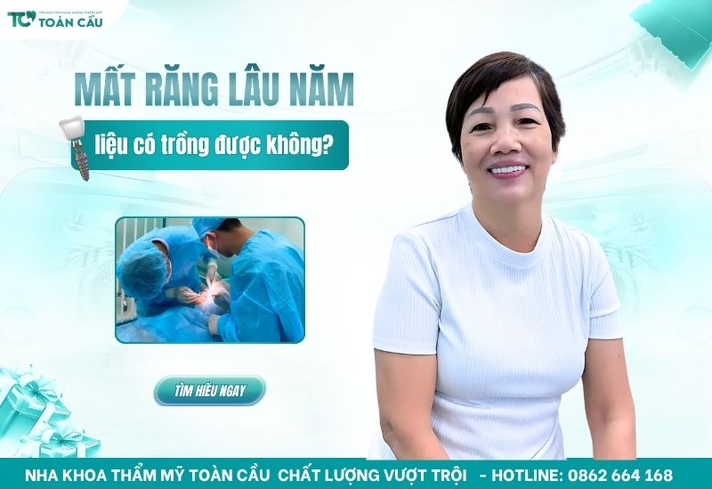 Mất răng lâu năm có trồng được không và chi phí bao nhiêu? 1 Mất răng lâu năm có trồng được không và chi phí bao nhiêu?