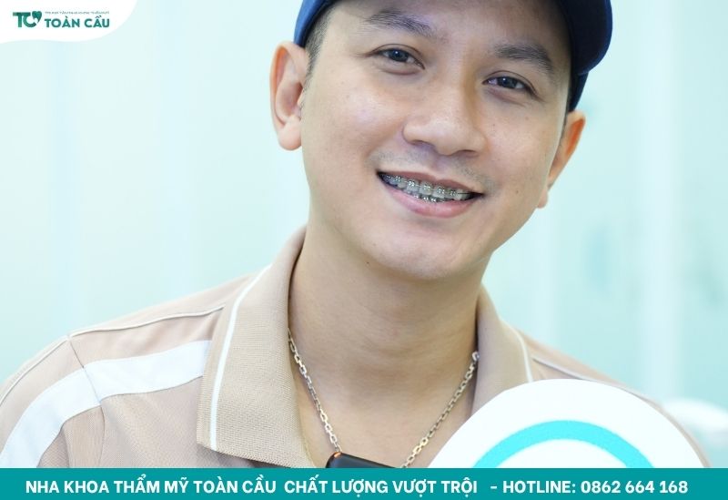 Quá trình kéo răng khi niềng diễn ra bao lâu thì hoàn tất? 6 Hình ảnh khách niềng răng tại Nha khoa Toàn Cầu