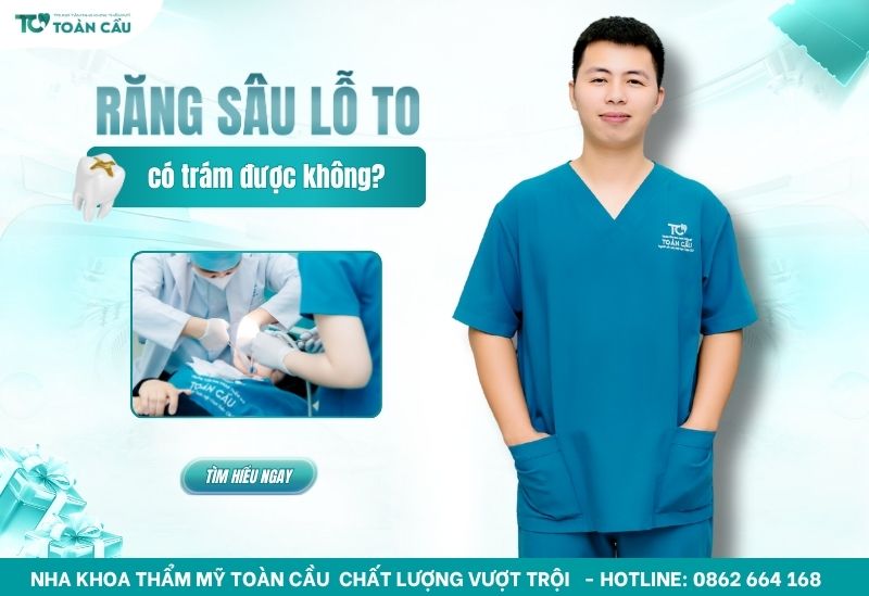 Răng bị sâu lỗ to có trám được không hay cần điều trị tủy? 7 răng bị sâu lỗ to có trám được không