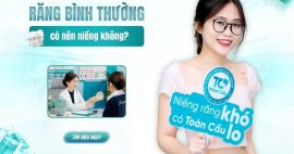 Răng bình thường có nên niềng không và có trở nên đẹp hơn?