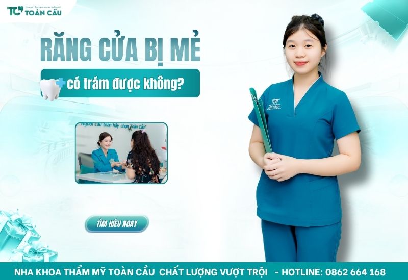 răng cửa bị mẻ