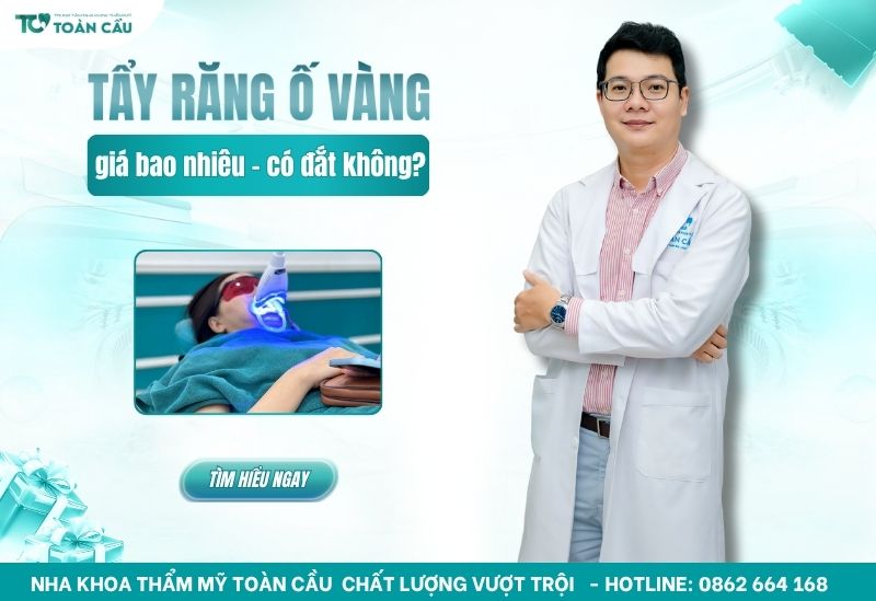Tẩy răng ố vàng giá bao nhiêu? Có đắt không?