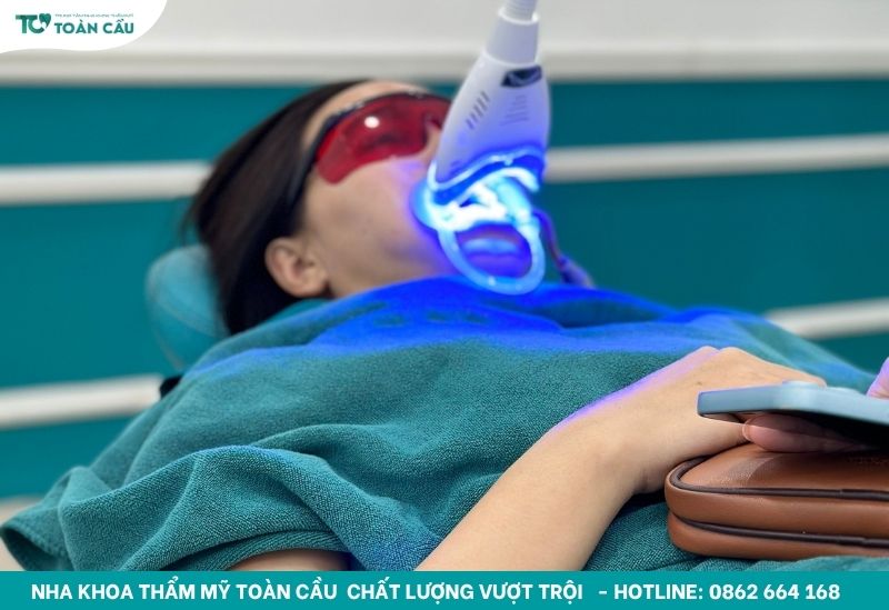 Tẩy răng ố vàng giá bao nhiêu? Có đắt không? 2 Tẩy răng ố vàng