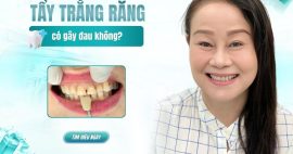 Lo lắng tẩy trắng răng có đau không? Tìm hiểu ngay!