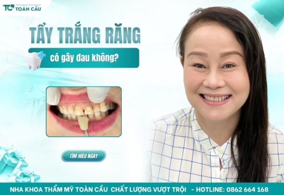Lo lắng tẩy trắng răng có đau không? Tìm hiểu ngay!
