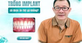 trồng răng implant có ăn được thịt gà không