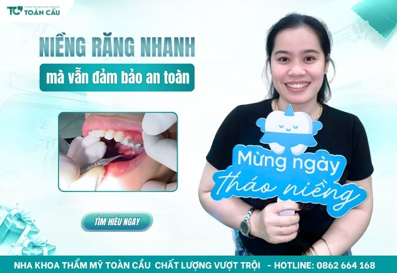 cách niềng răng nhanh nhất