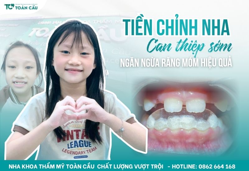 Cho con em can thiệp chỉnh nha sớm