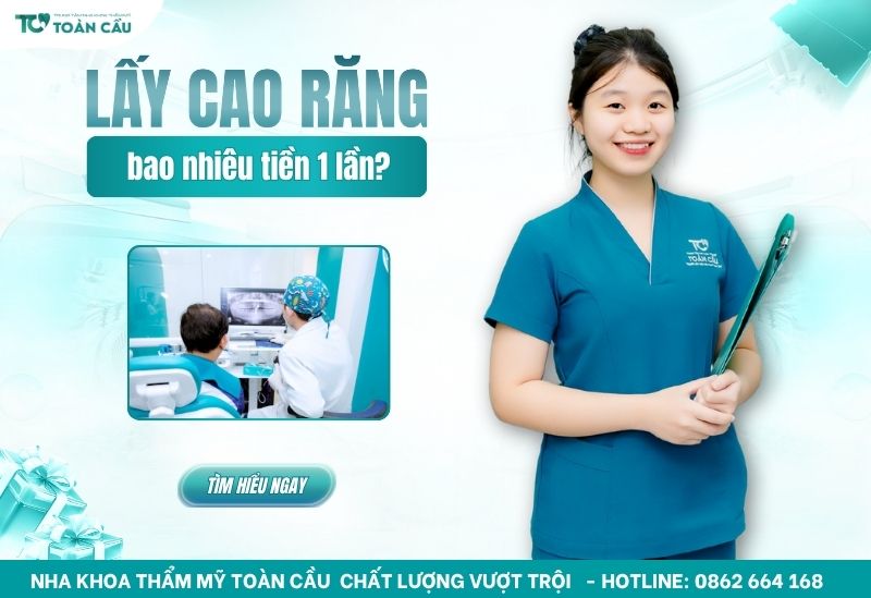 Chi phí lấy cao răng bao nhiêu tiền 1 lần cập nhật mới nhất 26 chi phí lấy cao răng