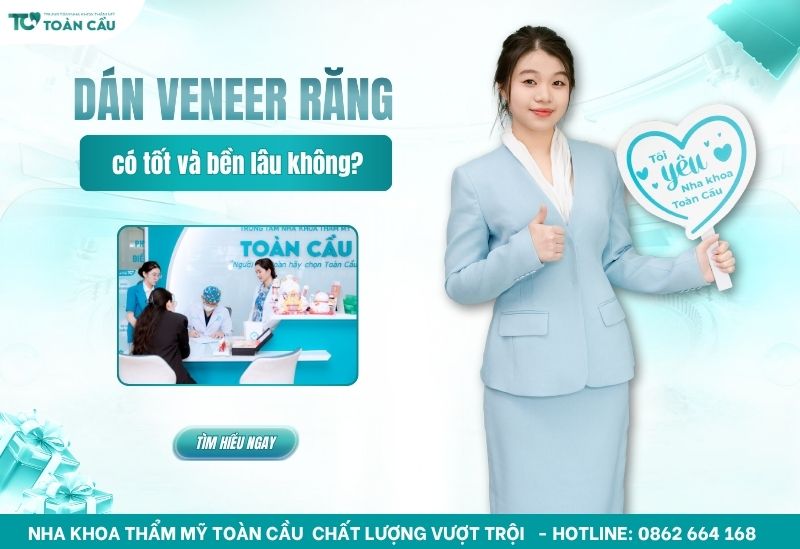 dán veneer răng có tốt không