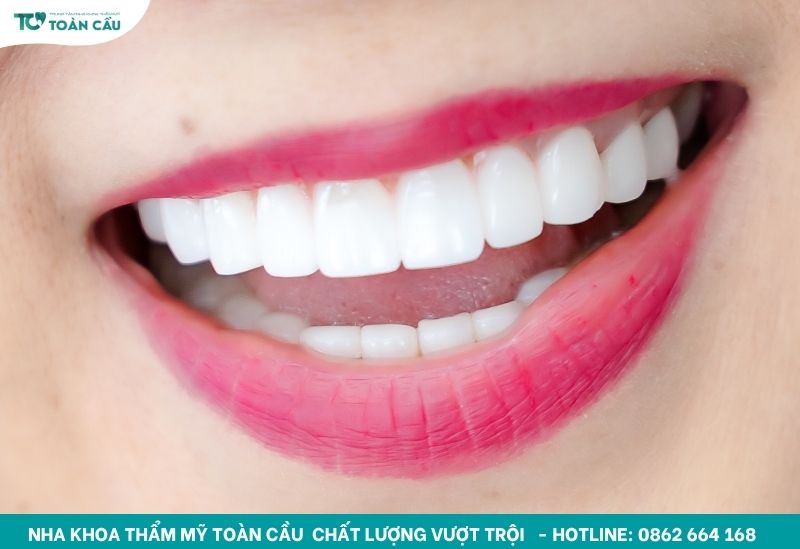 Chất liệu sứ đóng vai trò quan trọng