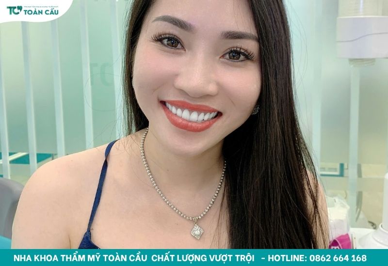 Khách hàng bọc sứ đẹp tại Toàn Cầu