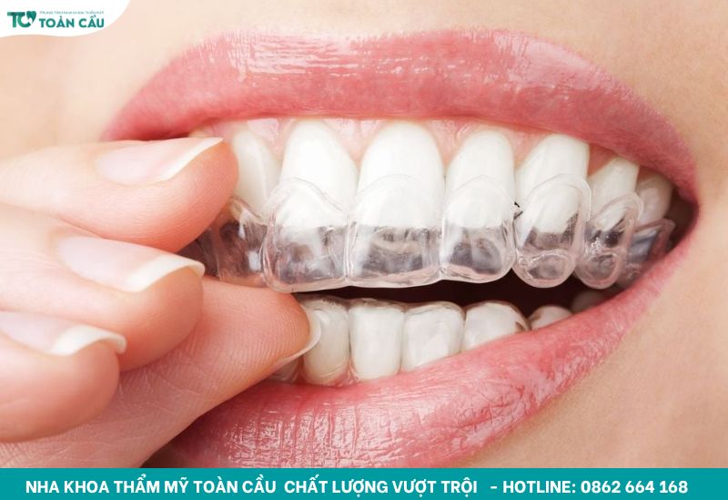 Hàm duy trì trong suốt đem lại sự tiện lợi, thẩm mỹ