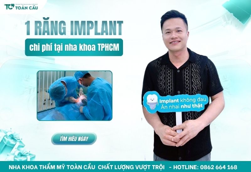 giá implant cho 1 răng