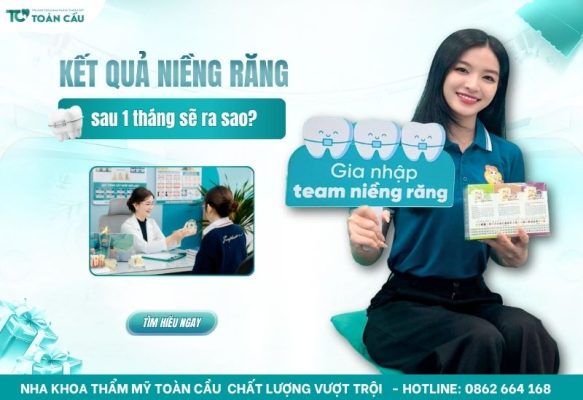 Kết quả niềng răng sau 1 tháng có thay đổi rõ không?