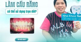 làm cầu răng mất bao lâu