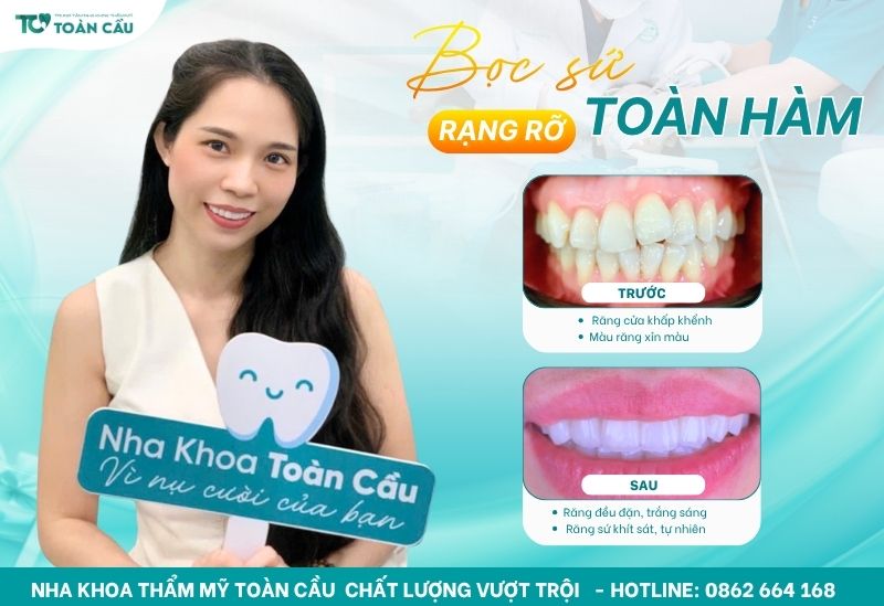 Khách hàng làm răng sứ tại Toàn Cầu