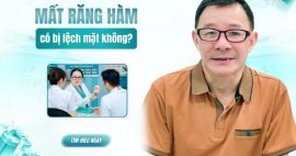 Mất răng hàm có bị lệch mặt không? Xem ngay mức độ nguy hiểm
