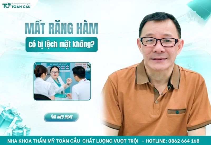 Mất răng hàm có bị lệch mặt không? Xem ngay mức độ nguy hiểm