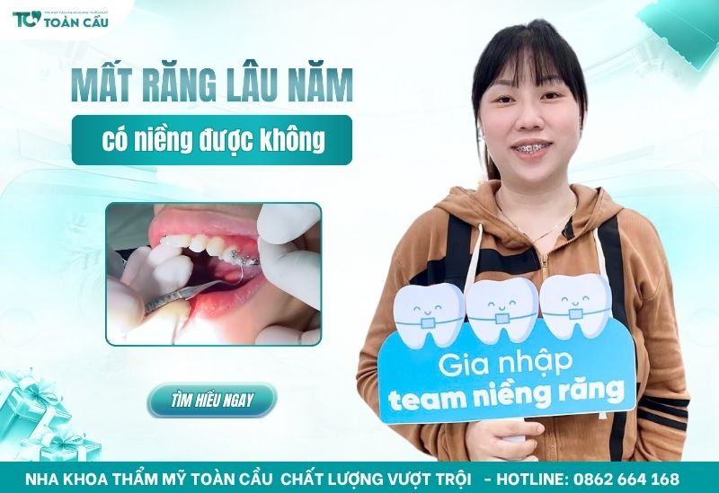 Giải đáp mất răng lâu năm có niềng được không 1 mất răng lâu năm có niềng được không