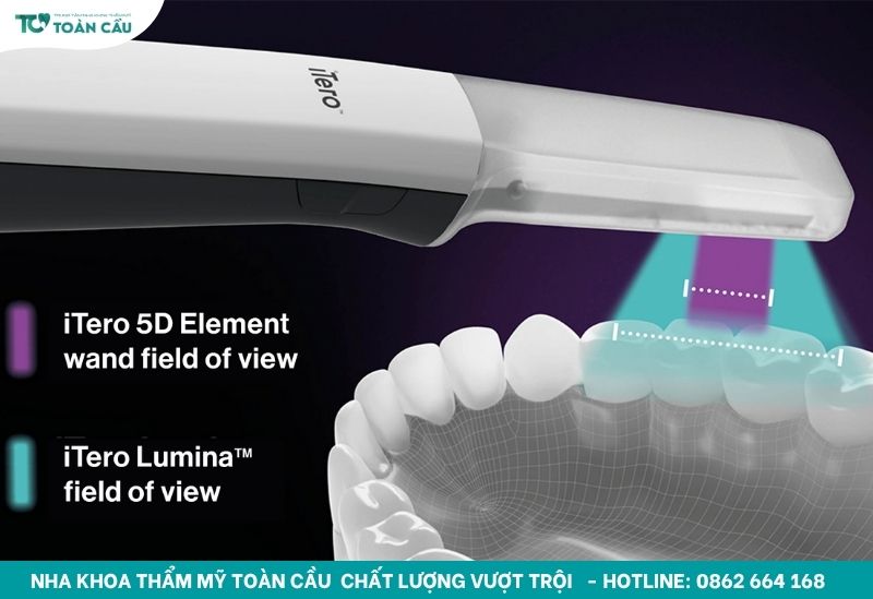 Máy scan trong miệng iTero