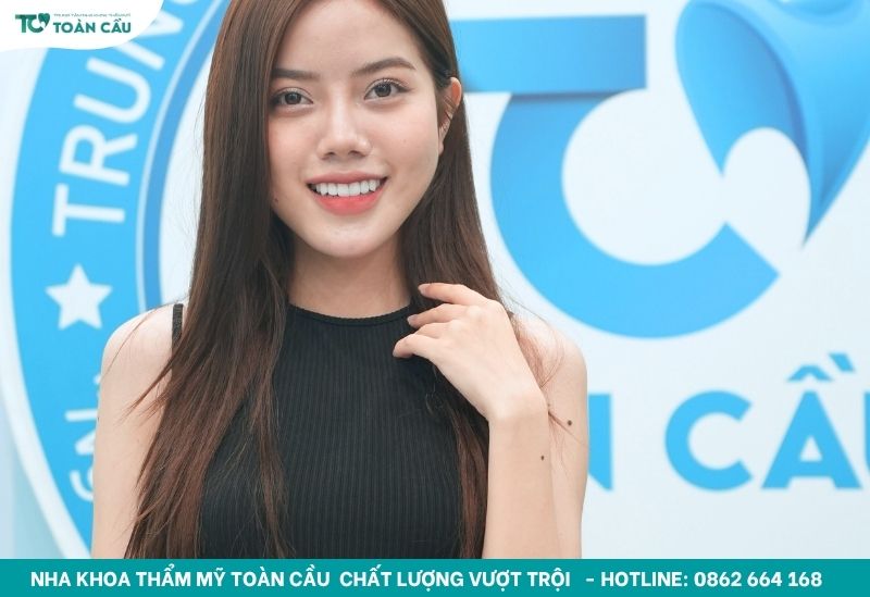 Dán sứ veneer là phương thức phục hình hiện đại