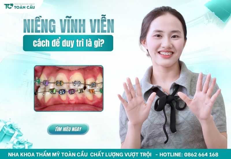 niềng răng có được vĩnh viễn không