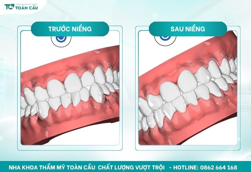 Hệ thống mô phỏng 3D tiên tiến