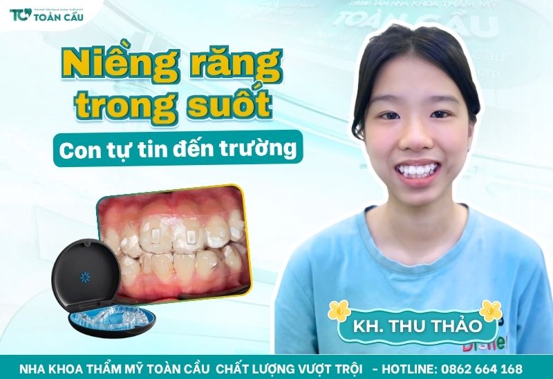 Khách hàng niềng răng invisalign tại Toàn Cầu