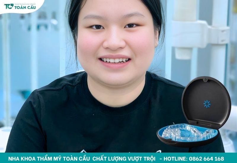 Bộ khay niềng được chế tạo riêng biệt