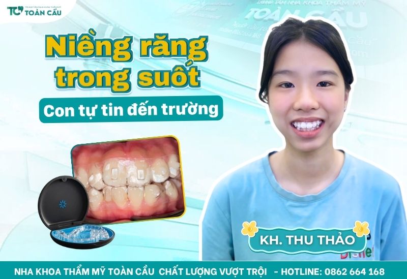 Khách hàng niềng răng trong suốt