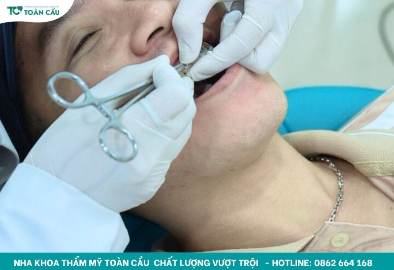 Niềng răng an toàn tại Toàn Cầu