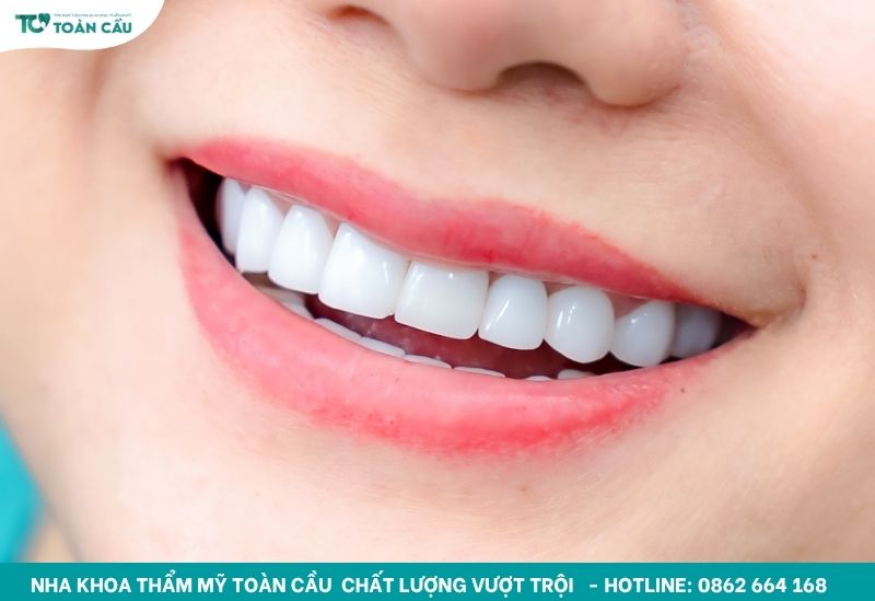 Nguyên nhân khiến răng cửa bị sâu bên trong và cách điều trị 2 Răng cửa tiếp xúc trực tiếp với thức ăn