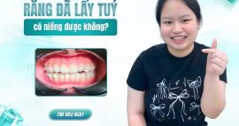 răng đã lấy tủy có niềng được không