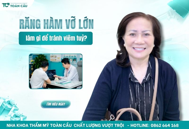 Răng hàm bị vỡ lớn nên làm gì để tránh viêm tủy và mất răng?