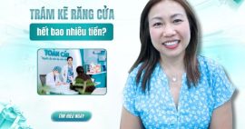 Trám sâu kẽ răng cửa bao nhiêu tiền? Trám loại nào tốt nhất?