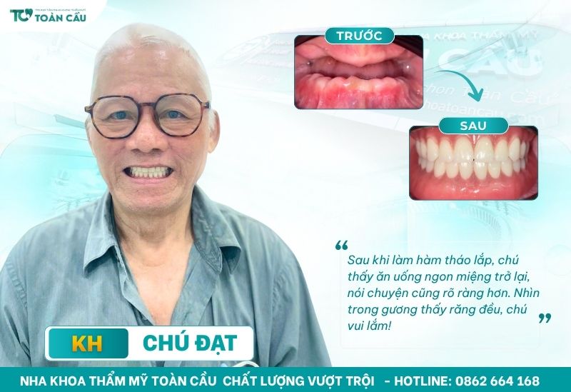 Hàm giả tháo lắp