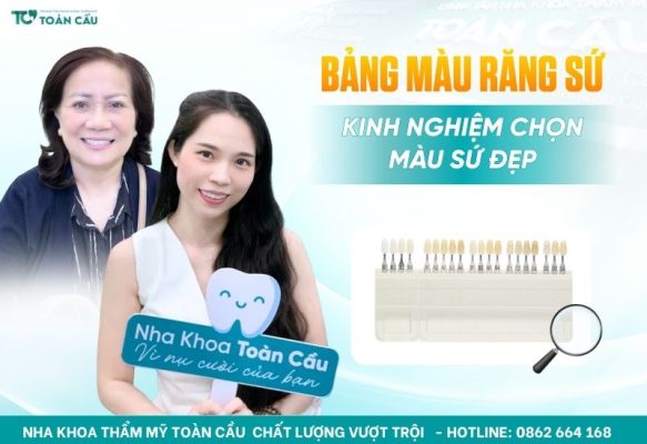 Bảng màu răng sứ